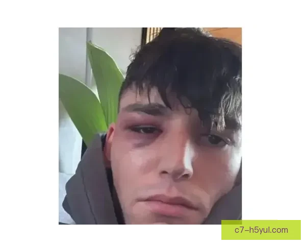 德国裁判科隆求婚后遭遇家庭袭击